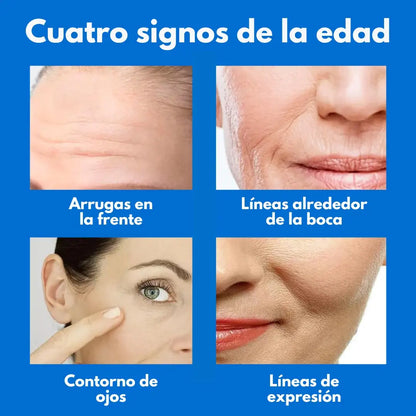 Botox Stock Solution Suero Antiarrugas